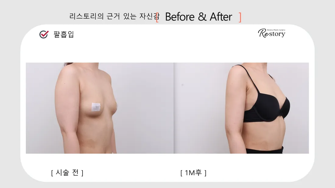 ボディ Before & After — リストーリー整形外科