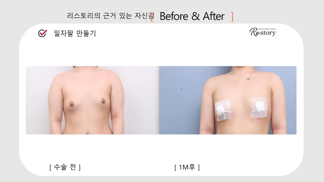 ボディ Before & After — リストーリー整形外科
