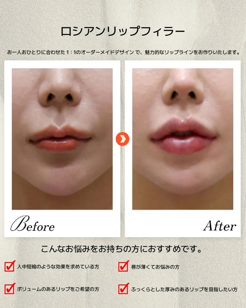 顎・口元・歯科 Before & After — ダシオンクリニック