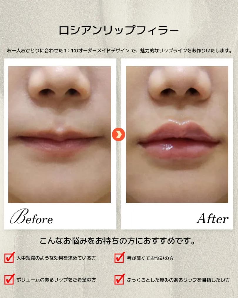 顎・口元・歯科 Before & After — ダシオンクリニック