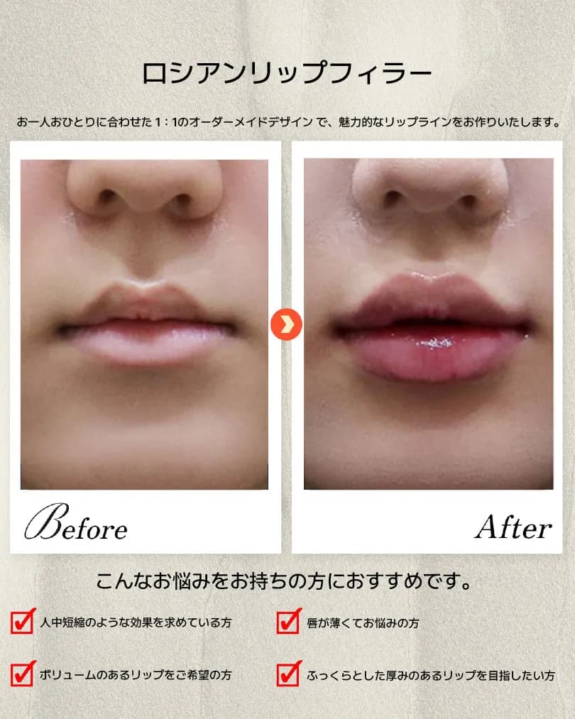 顎・口元・歯科 Before & After — ダシオンクリニック