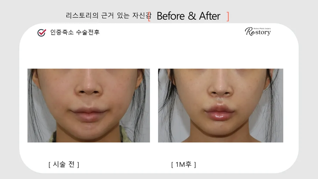 顎・口元・歯科 Before & After — リストーリー整形外科