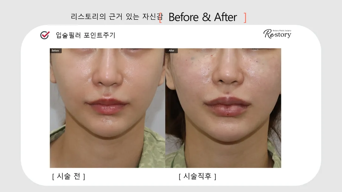 顎・口元・歯科 Before & After — リストーリー整形外科
