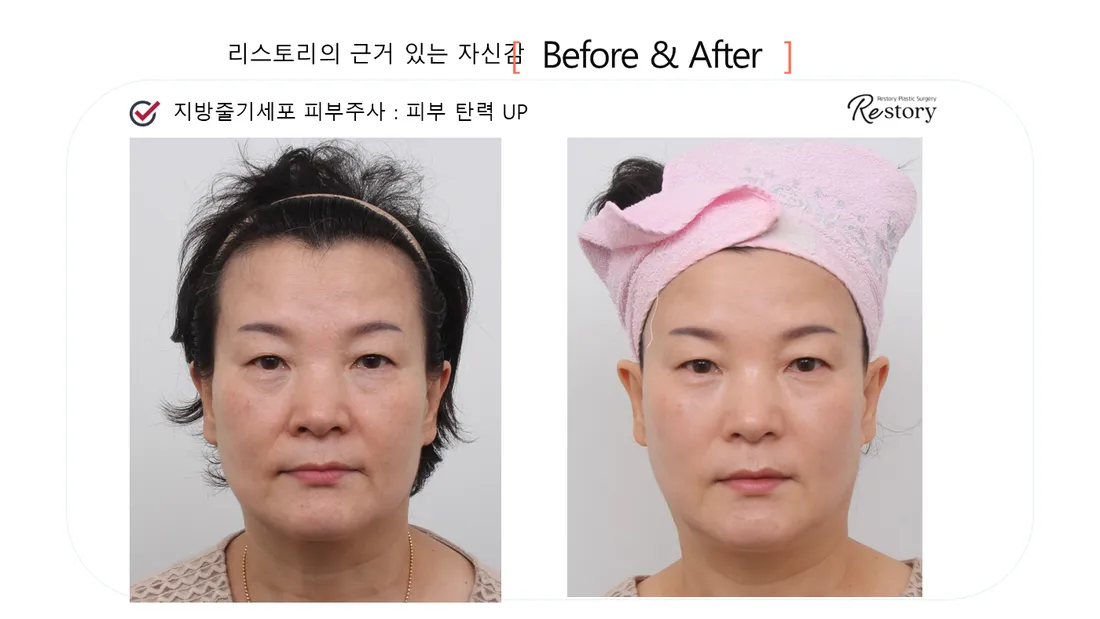 肌・美肌 Before & After — リストーリー整形外科