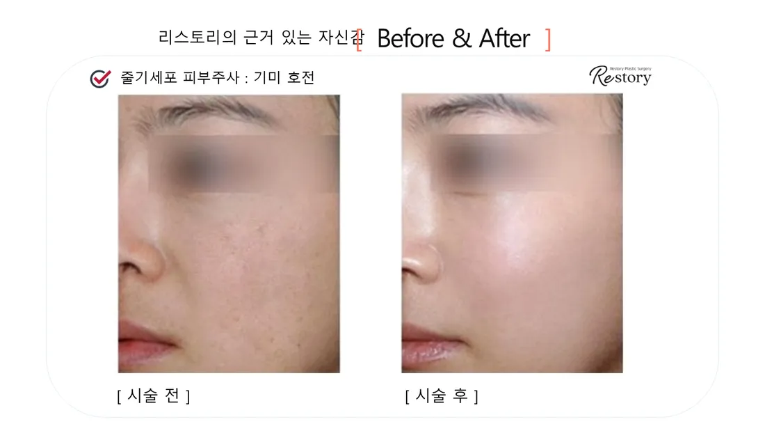 肌・美肌 Before & After — リストーリー整形外科
