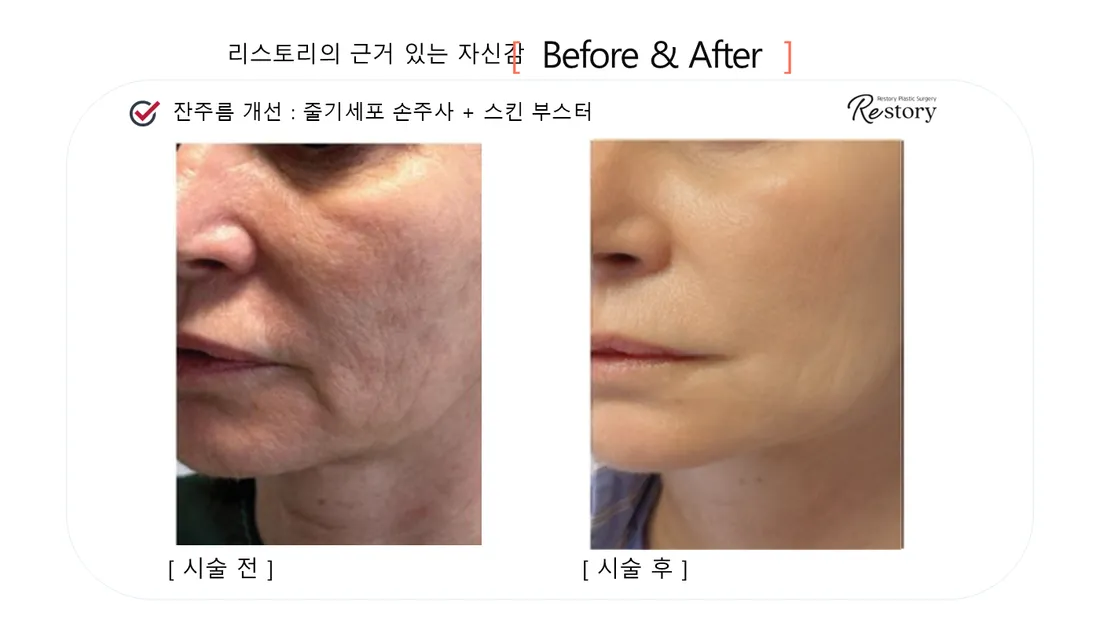 肌・美肌 Before & After — リストーリー整形外科