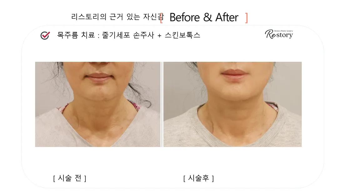 肌・美肌 Before & After — リストーリー整形外科