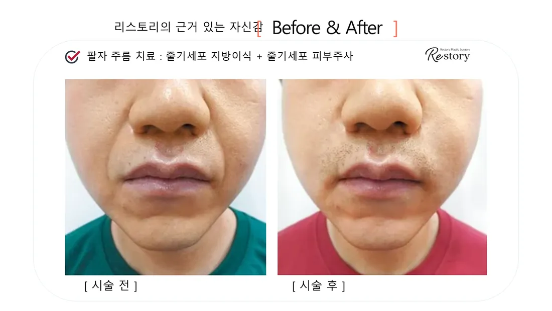 肌・美肌 Before & After — リストーリー整形外科