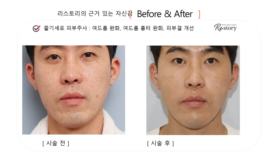 肌・美肌 Before & After — リストーリー整形外科
