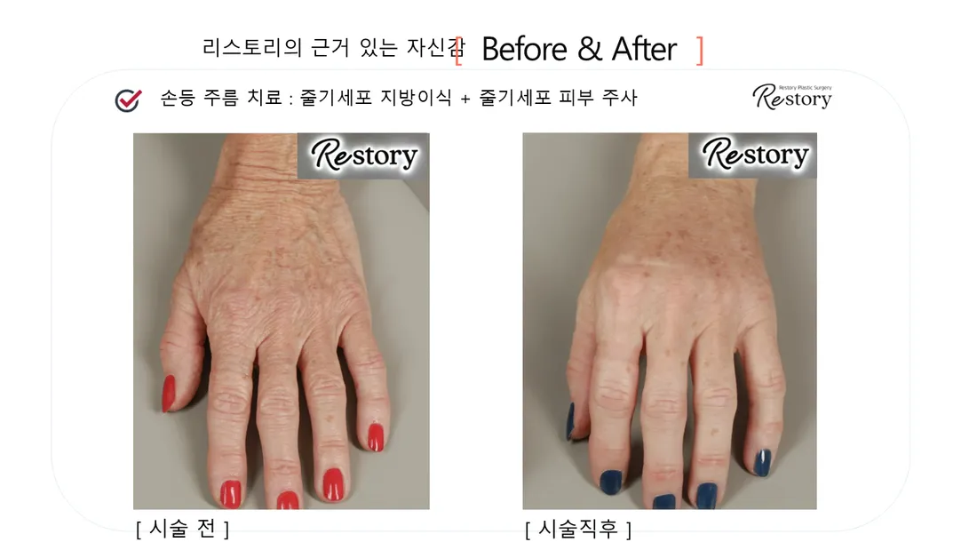 肌・美肌 Before & After — リストーリー整形外科