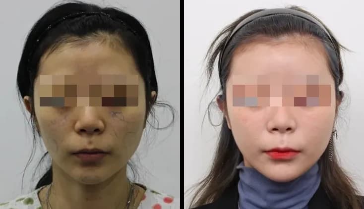 肌・美肌 Before & After — リストーリー整形外科