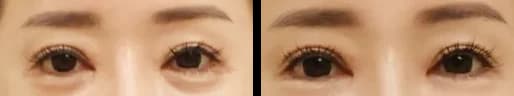 肌・美肌 Before & After — リストーリー整形外科