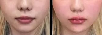 肌・美肌 Before & After — リストーリー整形外科