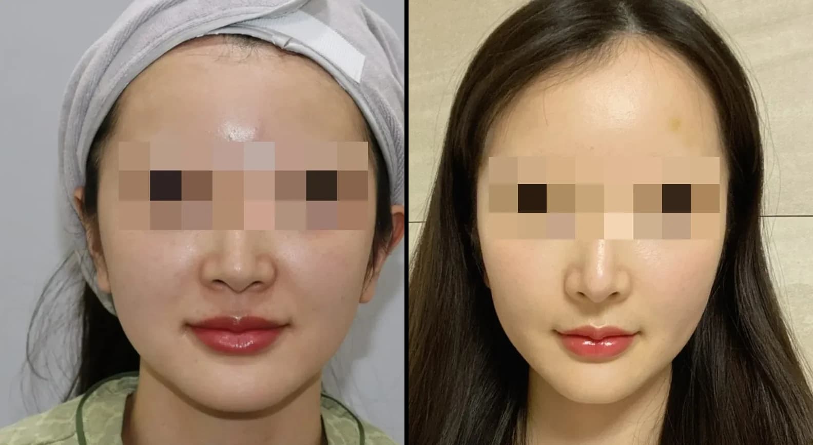 肌・美肌 Before & After — リストーリー整形外科