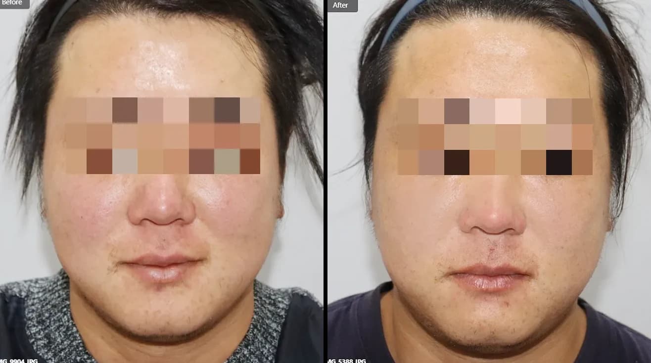 肌・美肌 Before & After — リストーリー整形外科