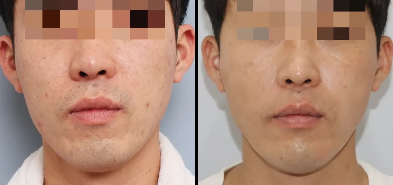 肌・美肌 Before & After — リストーリー整形外科