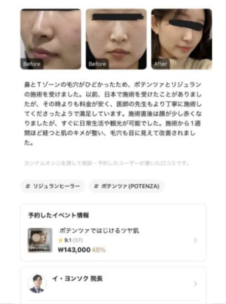 강남언니 리뷰 1